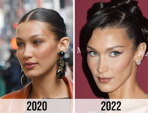 bella hadid buccal fat removal|Why The Rising Popularity of Buccal Fat Removal Is。